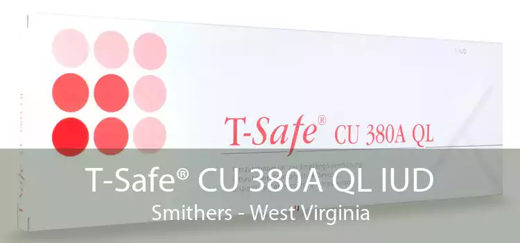 T-Safe® CU 380A QL IUD Smithers - West Virginia